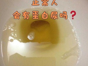 女沟厕 VOyeUrpss 尿隐：专业检测尿液，守护健康